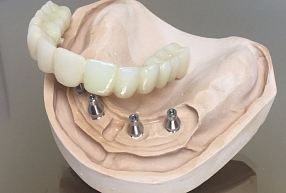 Zobu tehniskā laboratorija. SIA "Dentālā studija"