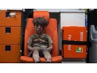 Karadarbībā ierautās Sīrijas ikdienas simbols: mazs sīriešu zēns, kurš redzams mediķu automašīnā. Bērna apģērbs ir saplēsts, un visu ķermeni klāj biezu putekļu un asiņu kārta, taču sejā nav redzamas emocijas. Zēns izglābts no sagrautas ēkas drupām Sīrijas pilsētā Alepo.