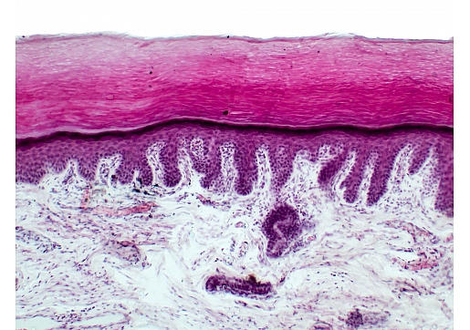 Histoloģisko izmeklējumu nozīme un pielietojums ādas saslimšanu diagnostikā