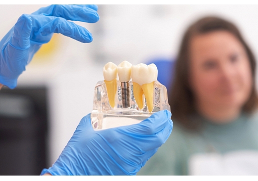 Zobu implantācija. Kad nepieciešams zobu implants un kā norit ārstēšana?