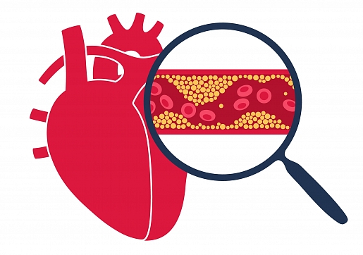 Kā uzveikt augstu holesterīnu 21. gadsimtā? Stāsta kardioloģe
