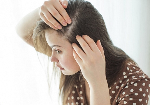 Kādi mēdz būt iemesli matu izkrišanai? Skaidro farmaceite