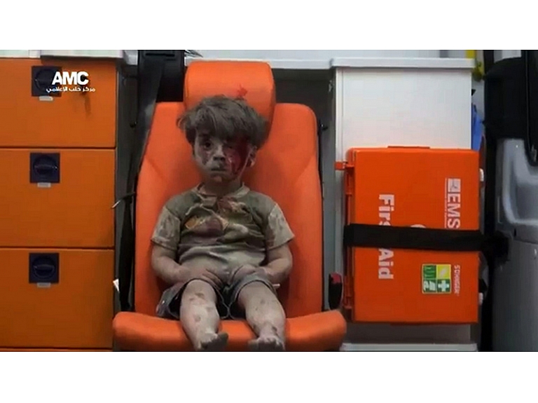 Karadarbībā ierautās Sīrijas ikdienas simbols: mazs sīriešu zēns, kurš redzams mediķu automašīnā. Bērna apģērbs ir saplēsts, un visu ķermeni klāj biezu putekļu un asiņu kārta, taču sejā nav redzamas emocijas. Zēns izglābts no sagrautas ēkas drupām Sīrijas pilsētā Alepo.