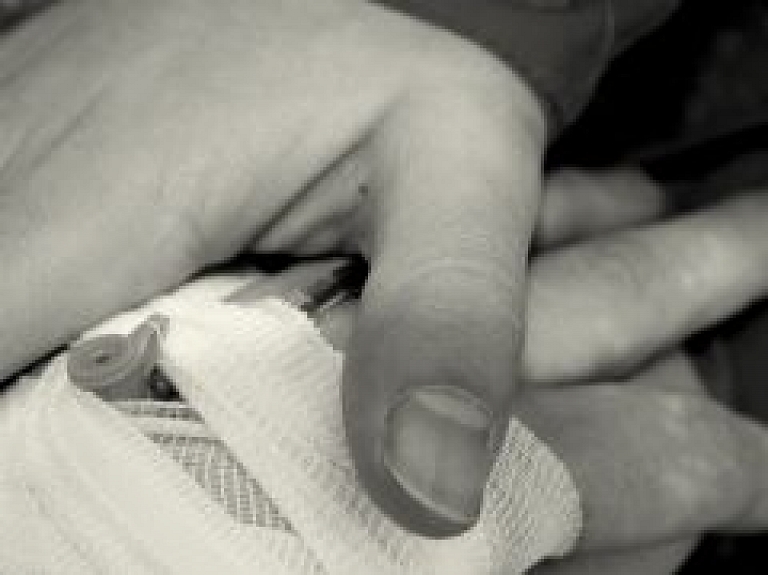 Latgalē vīrietis, iespējams, guvis pirkstu cīpslu bojājumus