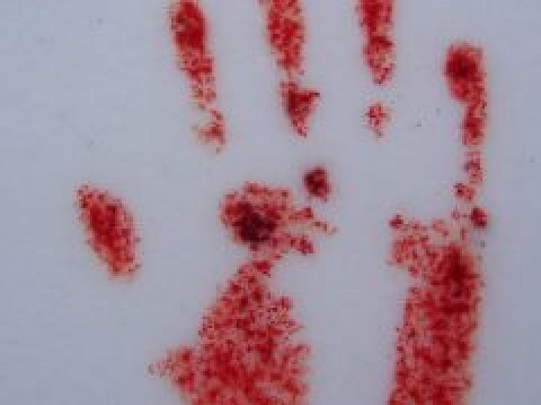 Latgalē vīrietis darba vietā gūst plēstas brūces plaukstā