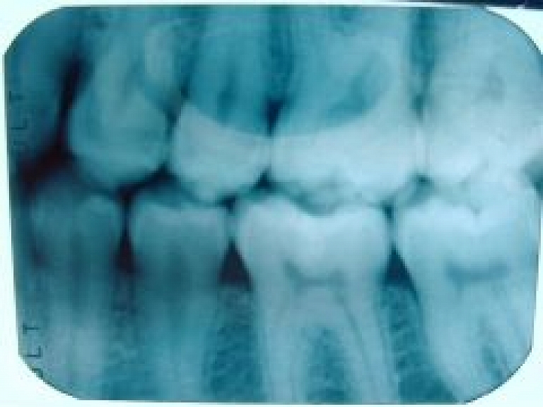 "Dentālā studija" pērn apgrozījusi 55 763 latus