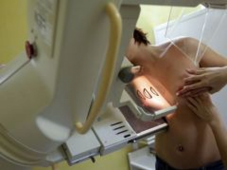 Janvārī Ainažos būs pieejami mobilā mamogrāfa pakalpojumi