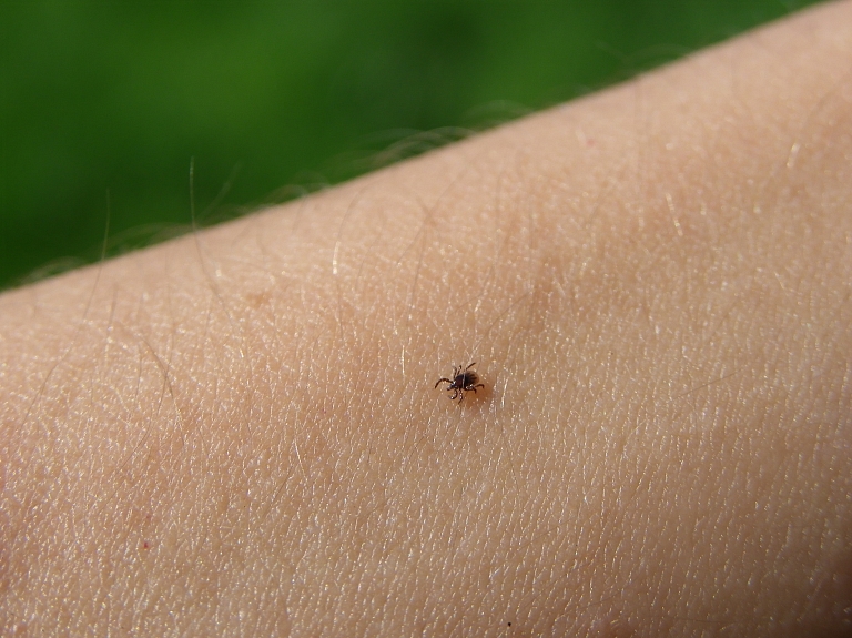 Infektoloģijas centrā pagājušā nedēļā nogādāts bērns ar piesūkušos ērci

