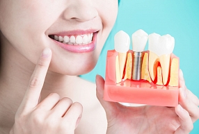 Zobārstniecības klīnika "Dental Guru" – modernākās tehnoloģijas un augstākā kvalitāte