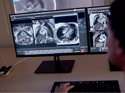 Magnētiskās rezonanses izmeklējumi