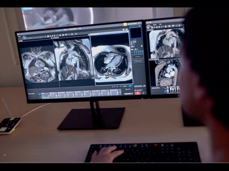 Magnētiskās rezonanses izmeklējumi