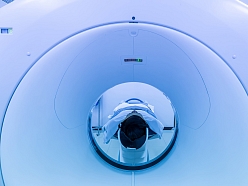 magnētiskās rezonanses izmeklējumi