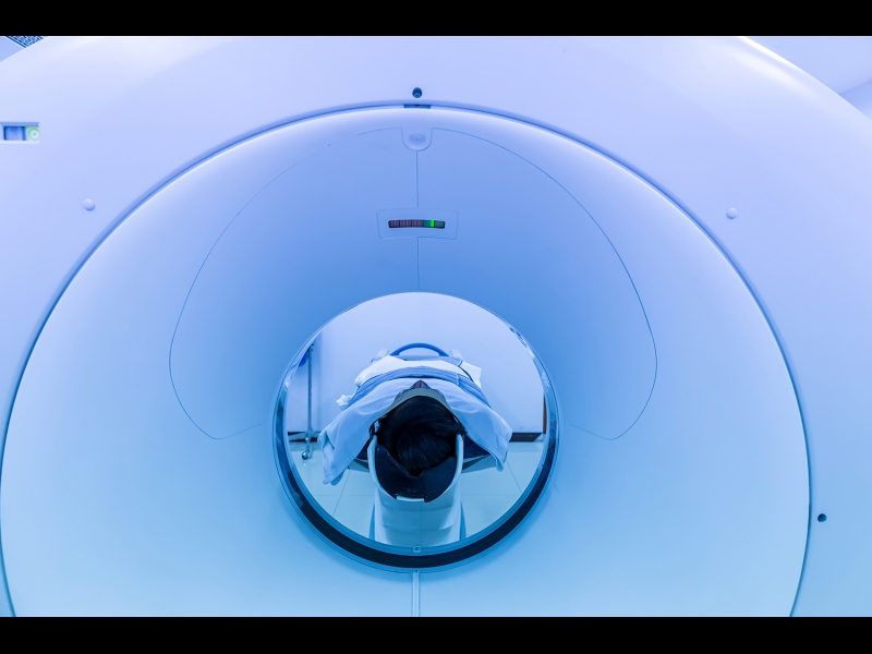 magnētiskās rezonanses izmeklējumi