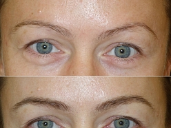 Mikropigmentācijas centrs