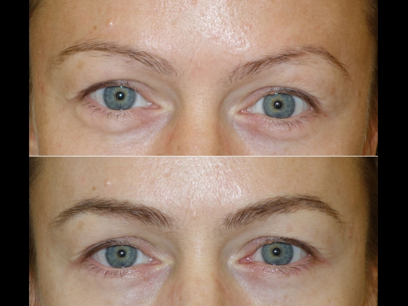 Mikropigmentācijas centrs