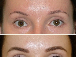 Mikropigmentācijas centrs