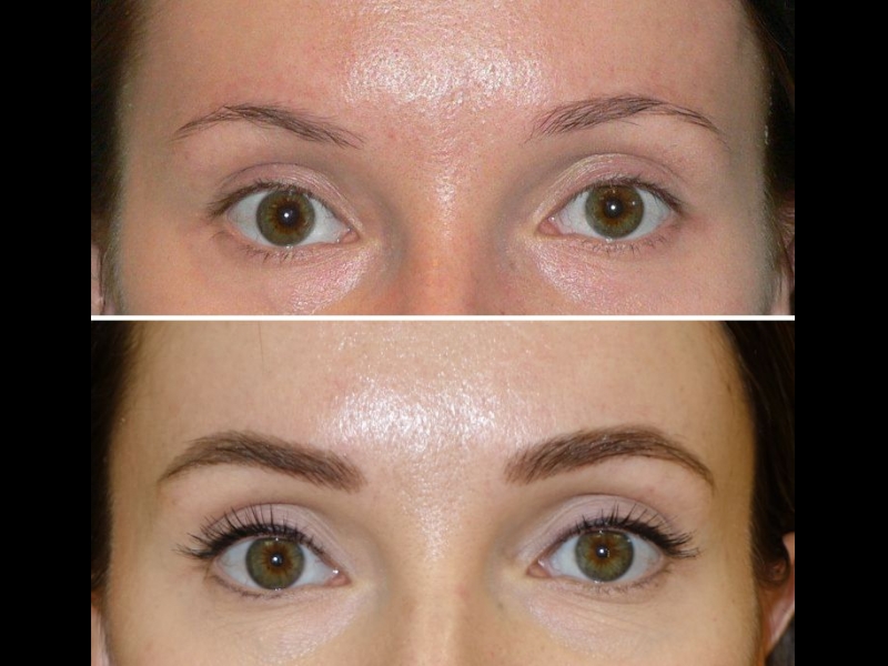 Mikropigmentācijas centrs