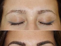 Mikropigmentācijas centrs