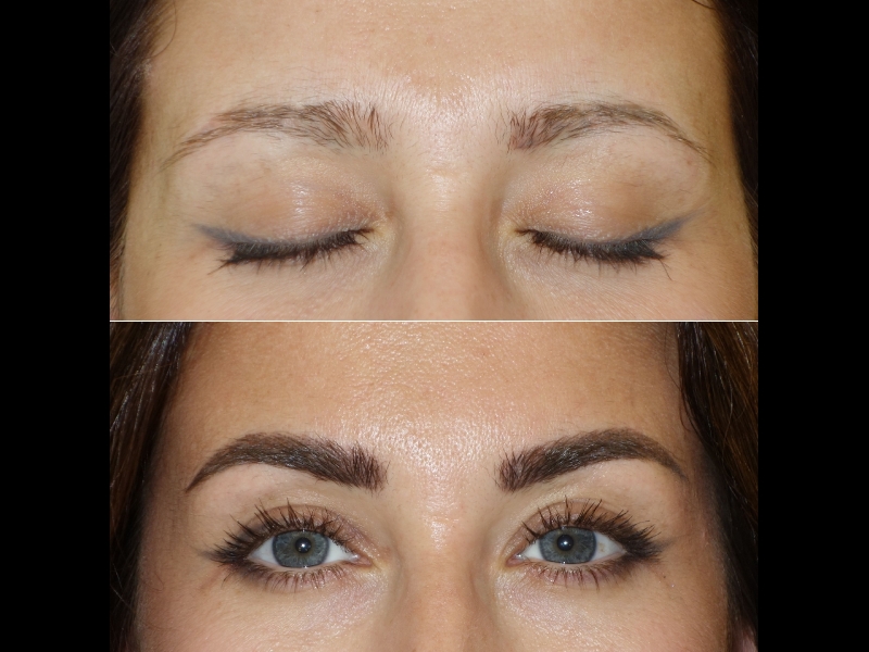 Mikropigmentācijas centrs