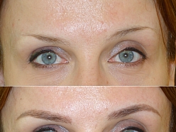 Mikropigmentācijas centrs