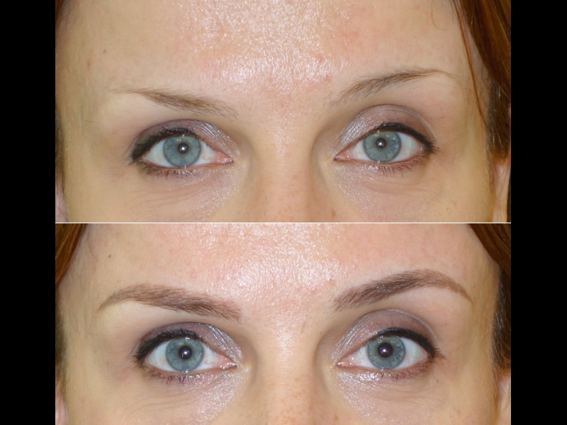 Mikropigmentācijas centrs