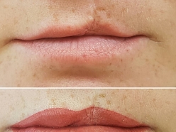 Mikropigmentācijas centrs