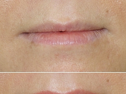 Mikropigmentācijas centrs