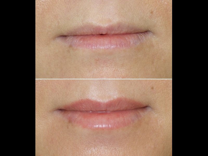 Mikropigmentācijas centrs