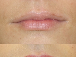 Mikropigmentācijas centrs