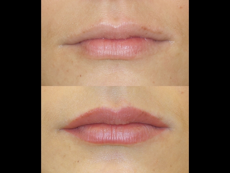 Mikropigmentācijas centrs