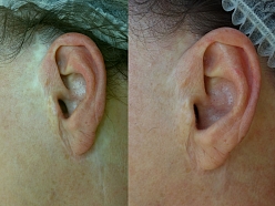 Mikropigmentācijas centrs