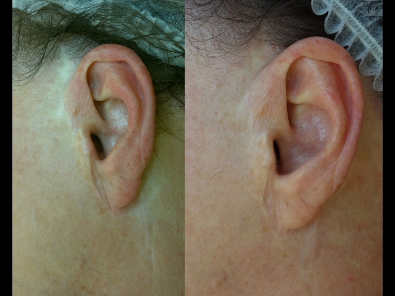 Mikropigmentācijas centrs