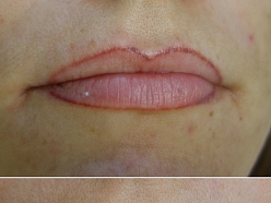 Mikropigmentācijas centrs