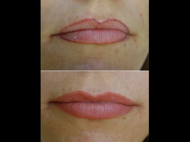 Mikropigmentācijas centrs