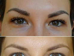 Mikropigmentācijas centrs