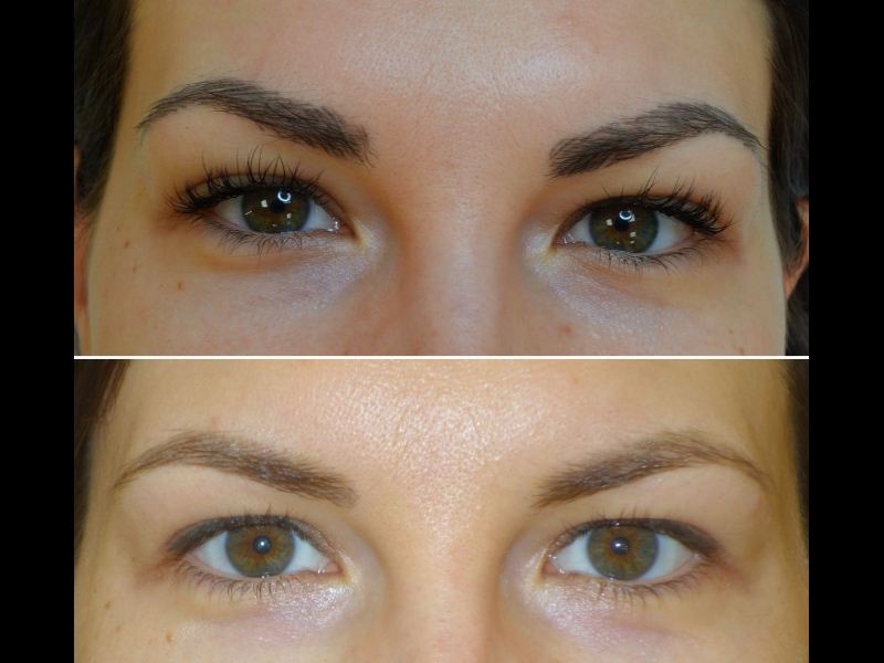 Mikropigmentācijas centrs