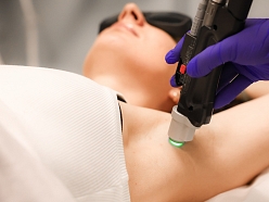 Lāzerepilācijas procedūras Rīgā