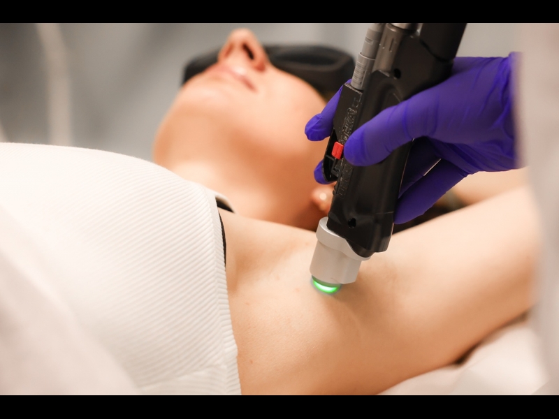 Lāzerepilācijas procedūras Rīgā