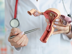 Uzskatāms un saprotams skaidrojums par sievietes reproduktīvo sistēmu, veselības izmaiņām un ārstēšanas iespējām, veicinot pacientes izpratni un līdzdalību ārstēšanas procesā.