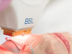 Vario Health Equipment, SIA, iekārta