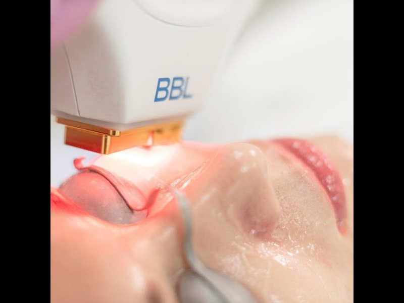 Vario Health Equipment, SIA, iekārta