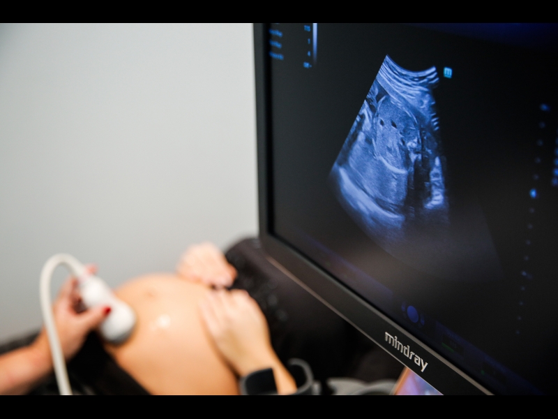 Grūtnieču ultrasonogrāfija