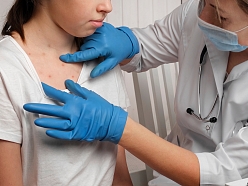 Dermatologa konsultācija, kuras laikā tiek izvērtētas ādas izmaiņas krūškurvja un kakla zonā, pievēršot uzmanību izsitumiem un ādas stāvoklim.