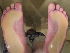 Podologa konsultācijas