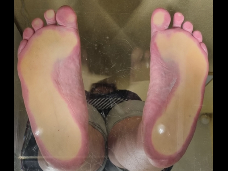 Podologa konsultācijas