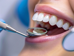 Detalizēta zobu apskate palīdz savlaicīgi atklāt un novērst problēmas.