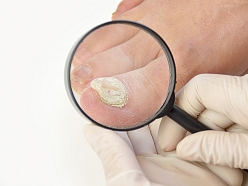 Podologa pakalpojumi