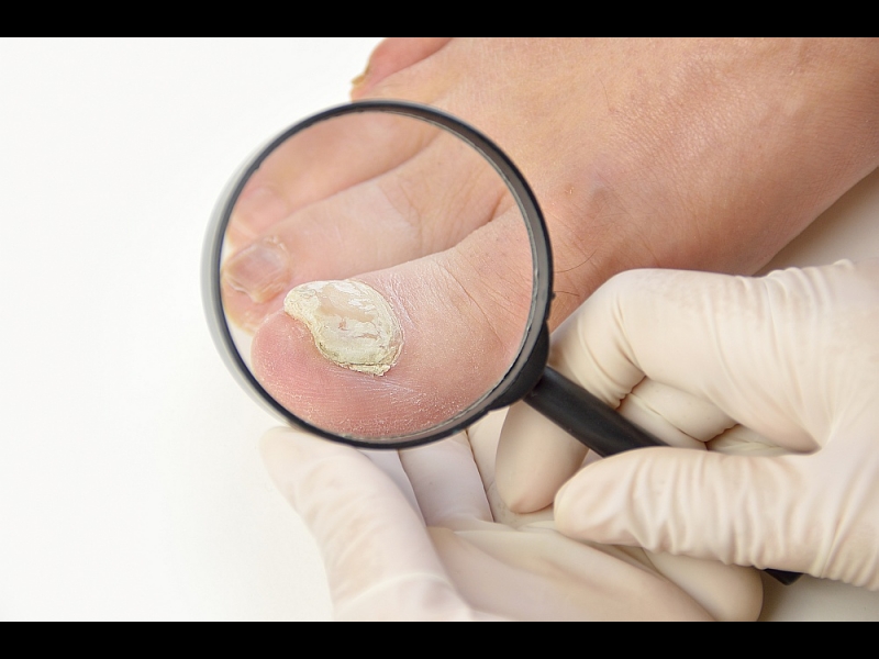 Podologa pakalpojumi