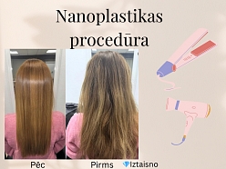 Matu rekonstrukcija – rezultāts pirms un pēc procedūras.