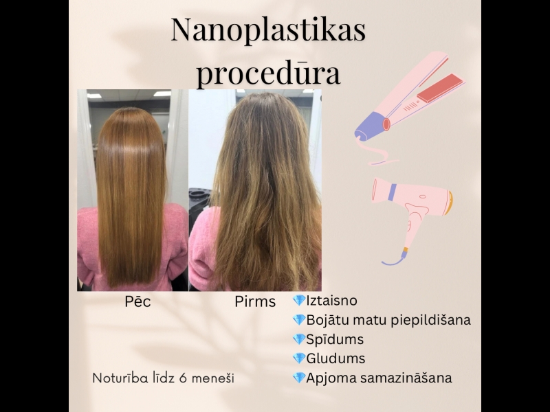 Matu rekonstrukcija – rezultāts pirms un pēc procedūras.